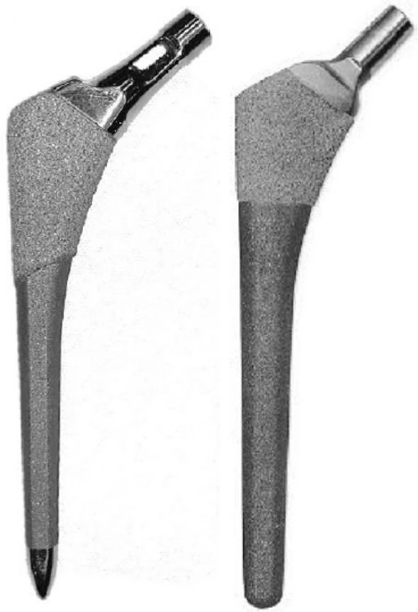 Implan Batang Femoral